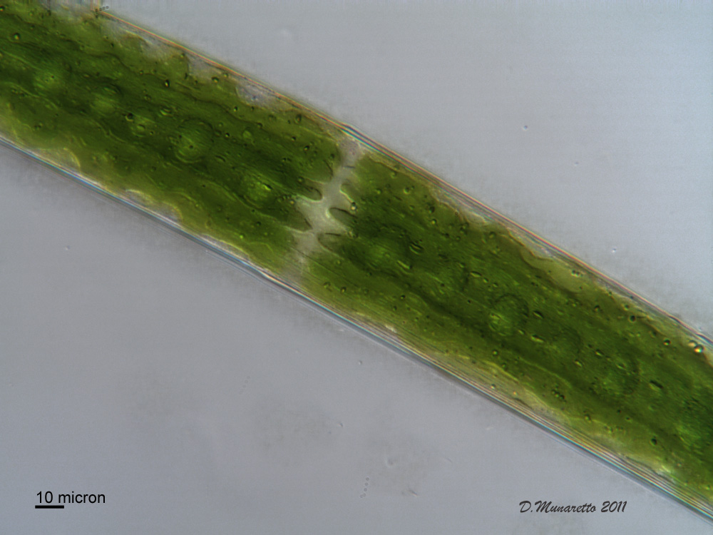 Closterium